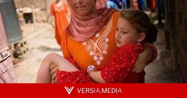 المشدد 15 سنة.. عقوبات بالقانون لختان الإناث